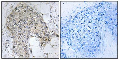 PPP1R2 (Ab-120/121) Antibody