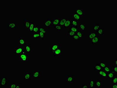 PPP1R8 Antibody