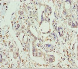 PPP1R8 Antibody