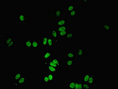 PPP1R8 Antibody