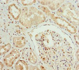 PPP1R8 Antibody