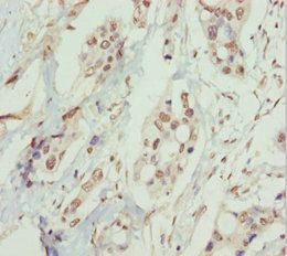 PPP1R8 Antibody