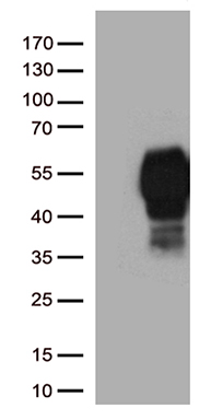 PPP2R1B Antibody