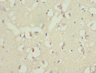 PPP2R1B Antibody