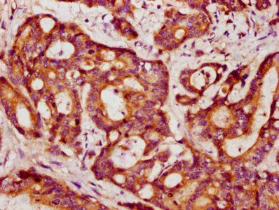 PPP2R1B Antibody