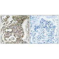 PPP2R1B Antibody
