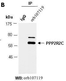 PPP2R2C (C) Antibody, Rabbit Polyclonal