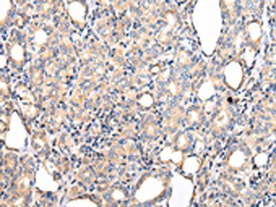 PPP5C Antibody