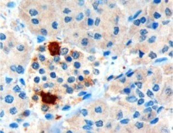 Pancreatic Polypeptide/PPY Antibody