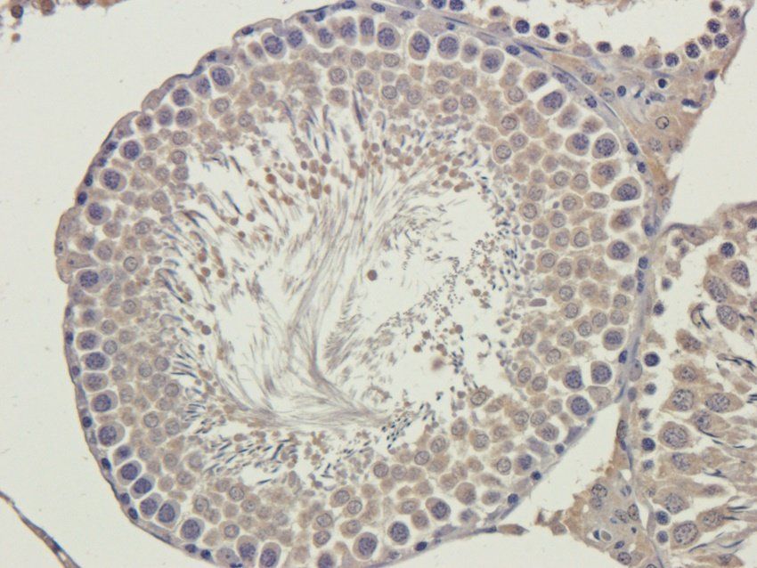 PQBP1 Rabbit Polyclonal Antibody