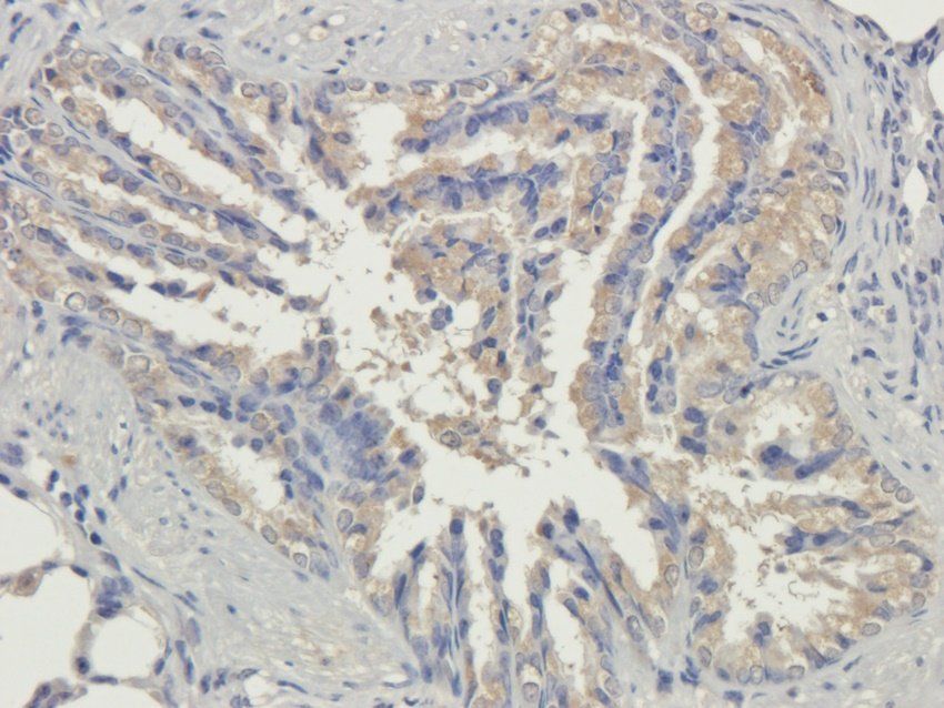 PQBP1 Rabbit Polyclonal Antibody