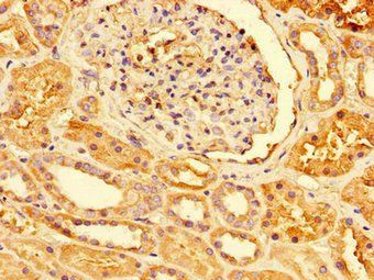 PRDX3 Antibody