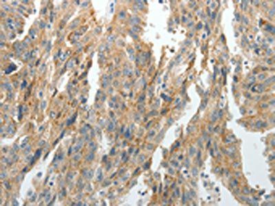 PRDX5 Antibody