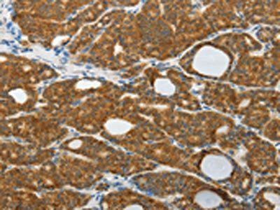 PRDX5 Antibody