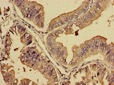 PREB Antibody