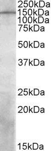 PREX1 Antibody