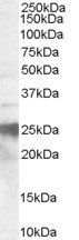 Prion Protein (143-153) Antibody