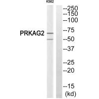 PRKAG2 Antibody