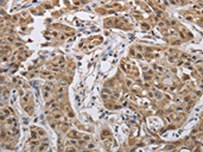 PRKAR1B Antibody