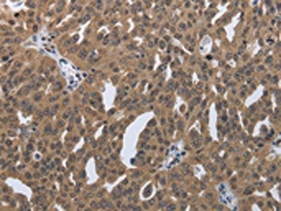PRKAR1B Antibody