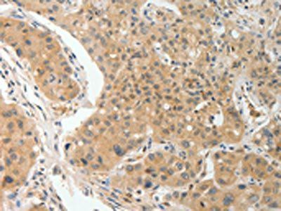 PRKCA Antibody