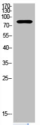 PRKCZ Antibody