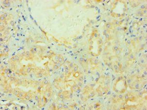 PRMT2 Antibody