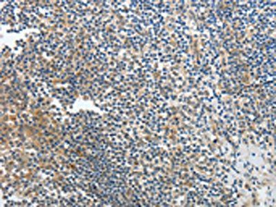 PRMT2 Antibody