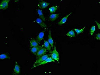 PROC Antibody