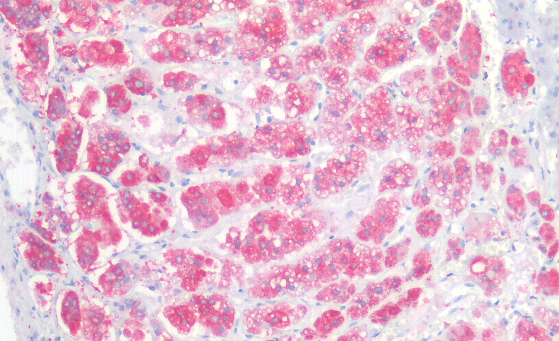 CD56/NCAM1 (isoform 2) Antibody