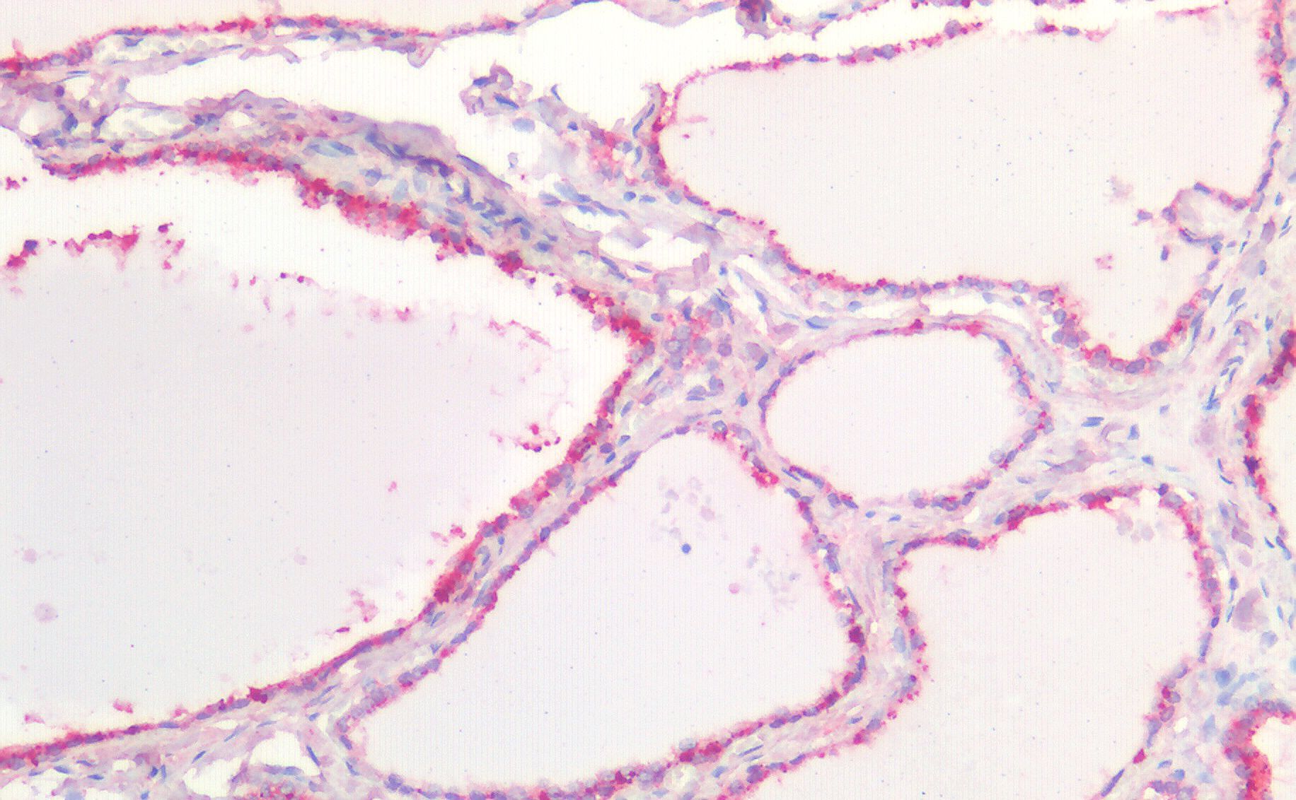 CDH1 (aa662-675) Antibody