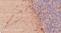 Doublecortin/DCX (aa232-242) Antibody