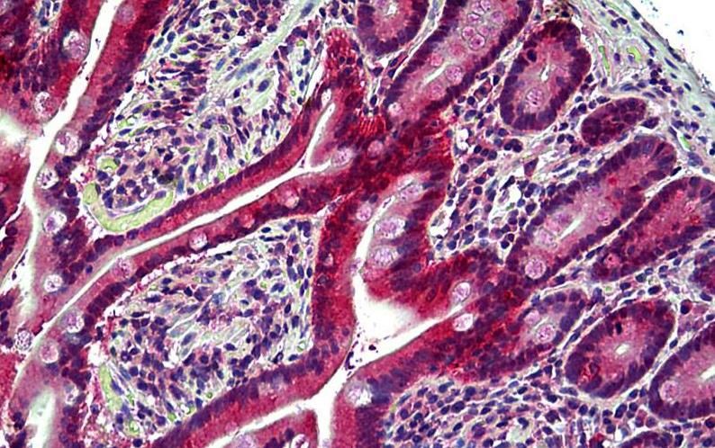 EPHB6 Antibody