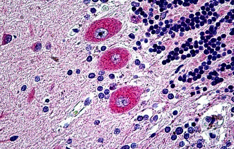 EPHB6 Antibody