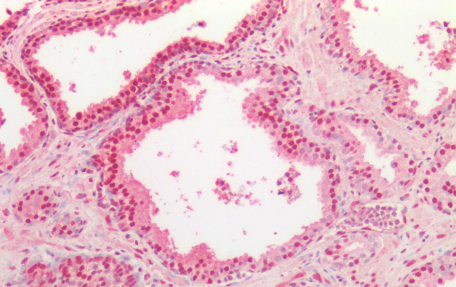 TDP-43 Antibody