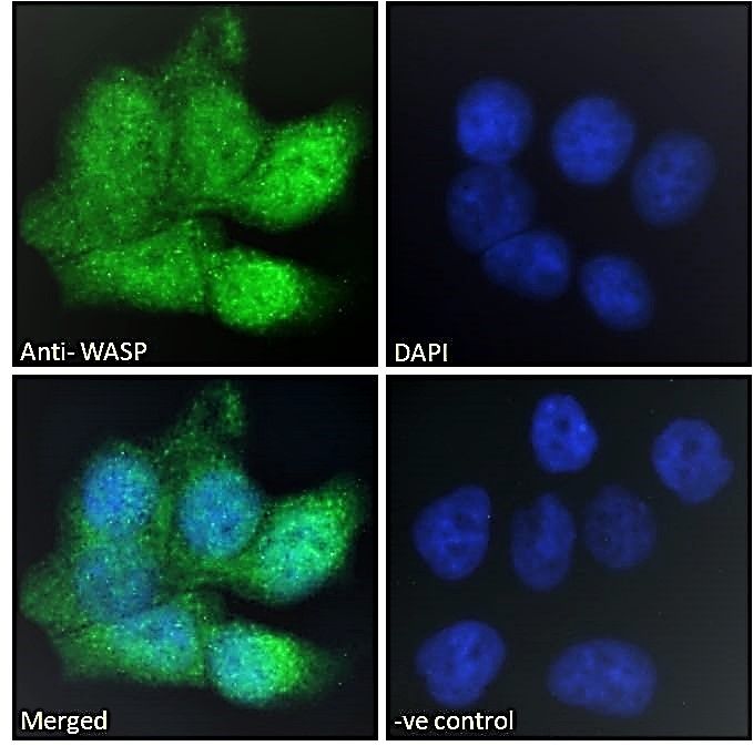 Wiskott-Aldrich Syndrome/WASP Antibody