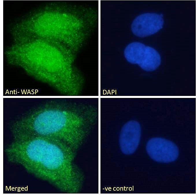 Wiskott-Aldrich Syndrome/WASP Antibody