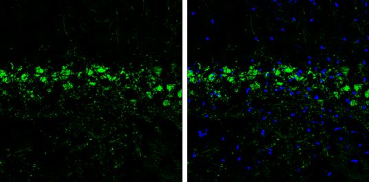 prodynorphin Antibody