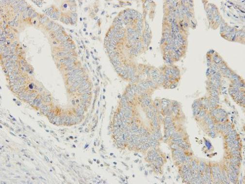 prodynorphin Antibody