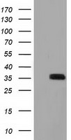 PFN1 Antibody