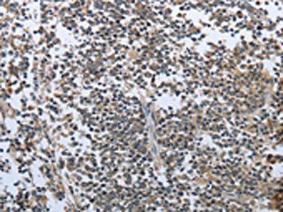 PRL Antibody