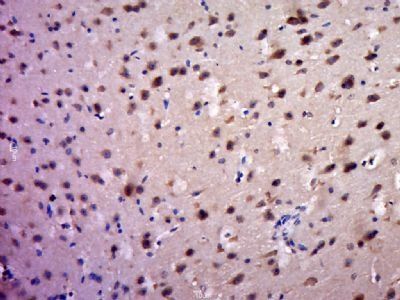 PROP1 Rabbit Polyclonal Antibody