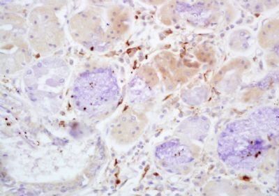 Properdin Rabbit Polyclonal Antibody
