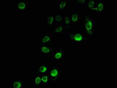 Propionyl-HIST1H3A (K23) Antibody
