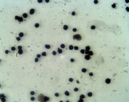 Rabbit Human Proprotein convertase subtilisin/kexin type 9 (PCSK9), NARC1 Antibody
