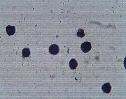Rabbit Human Proprotein convertase subtilisin/kexin type 9 (PCSK9), LDLR-binding epitope blocking Antibody