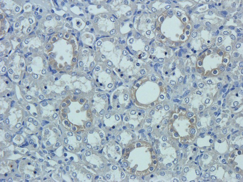 Prostaglandin E synthase 2 antibody