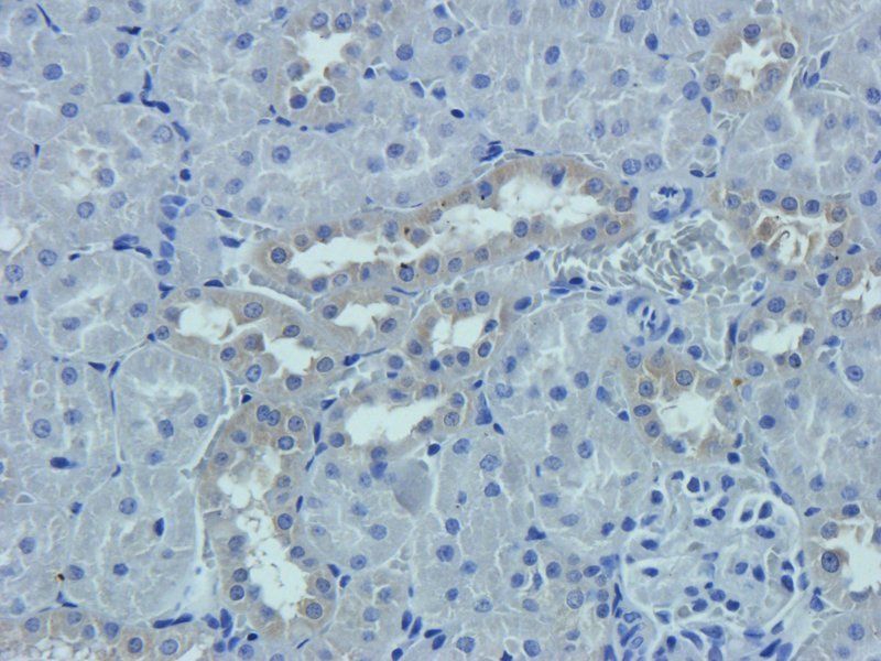 Prostaglandin E synthase 2 antibody