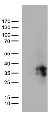 Prostate Specific Antigen (KLK3) Mouse Monoclonal Antibody