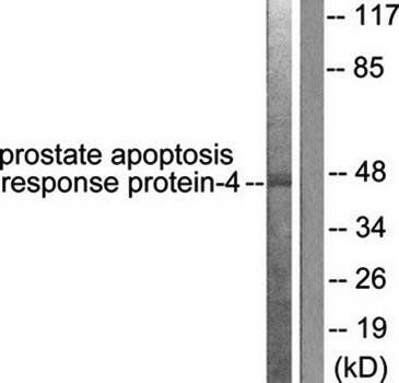 Prostate Apoptosis Response protein-4 Antibody